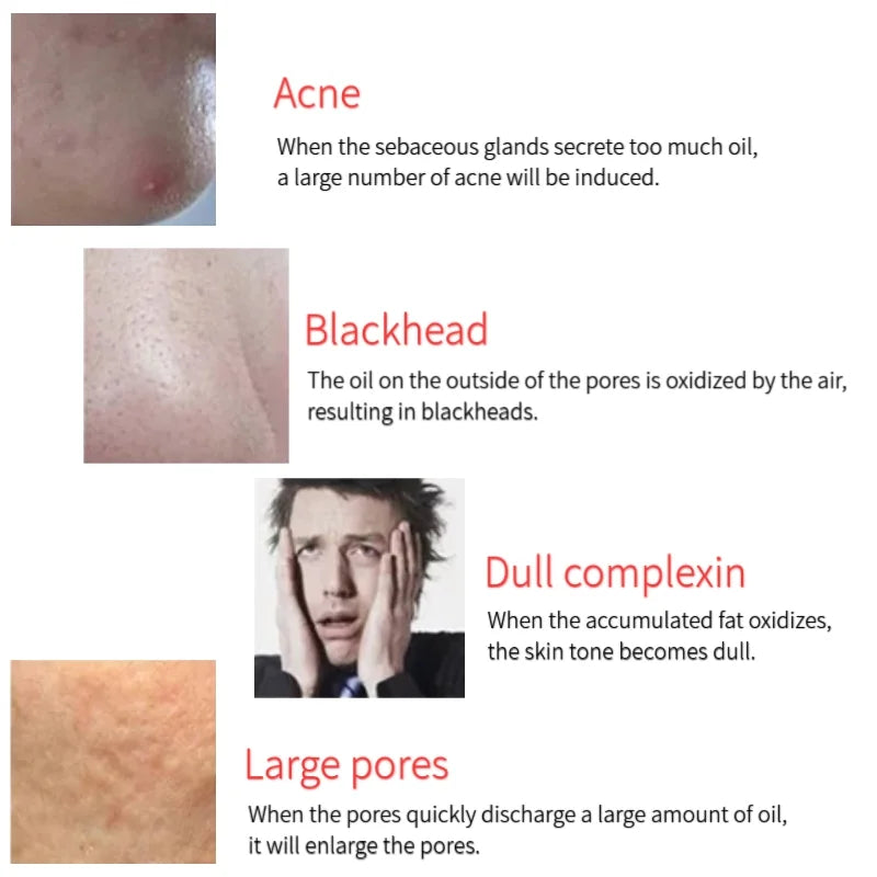 2 in 1 Oil Control Natural Volcanic Face Roller